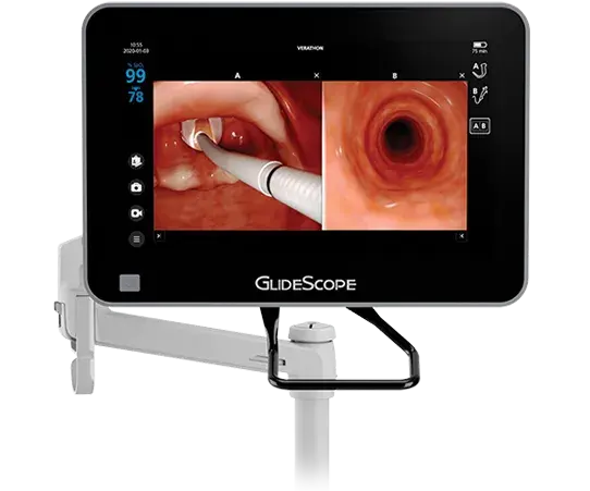 GlideScope Core system