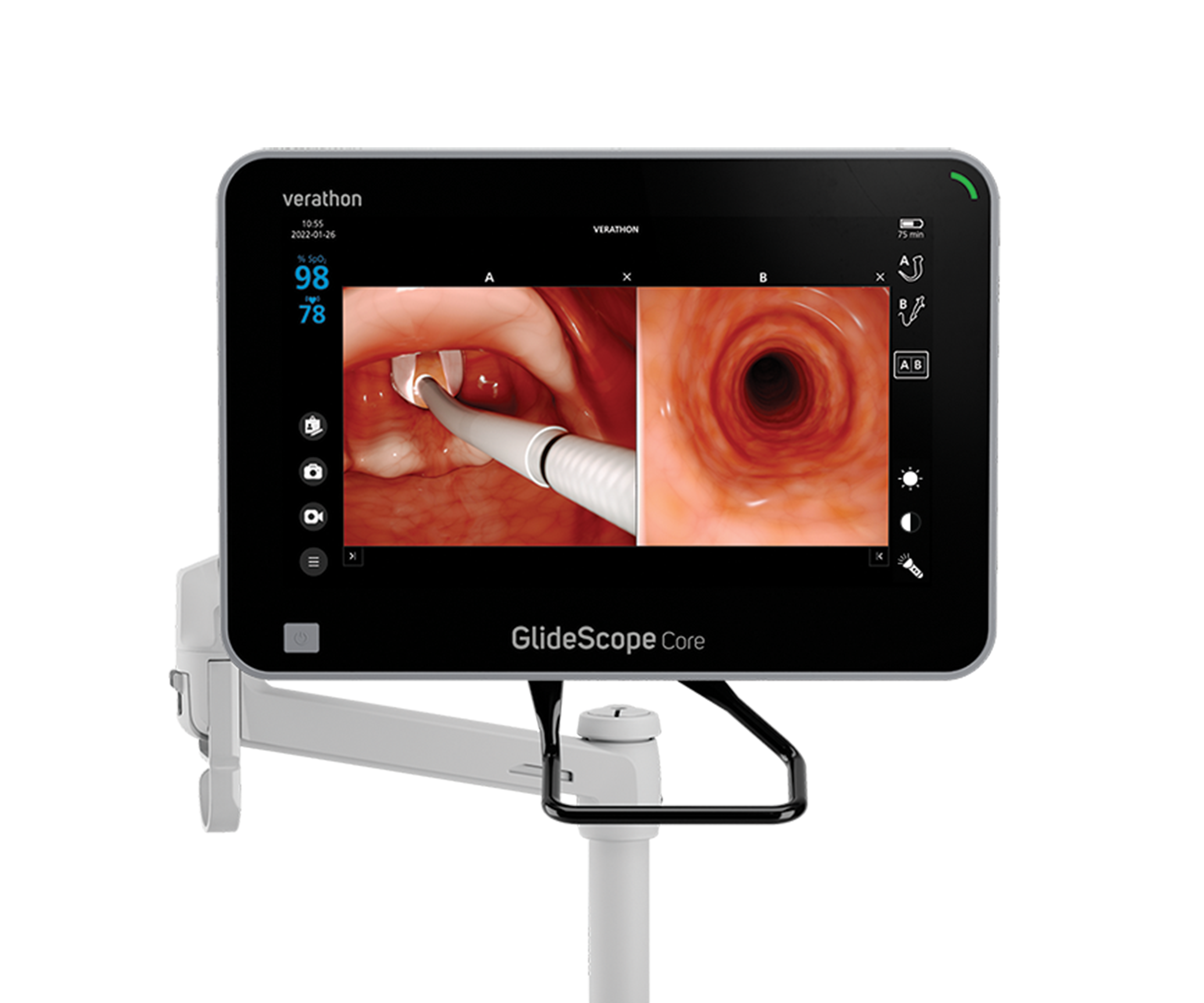 GlideScope_core-15_front-workstation-crop.png