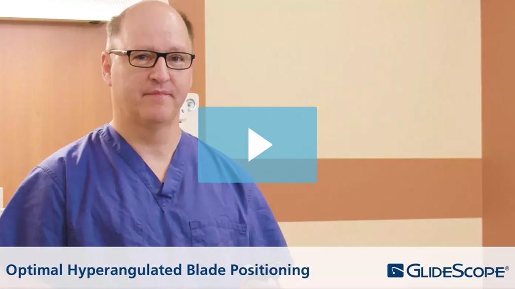 Optimal-Hyperangulated-Blade-Positioning