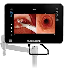 GlideScope Core