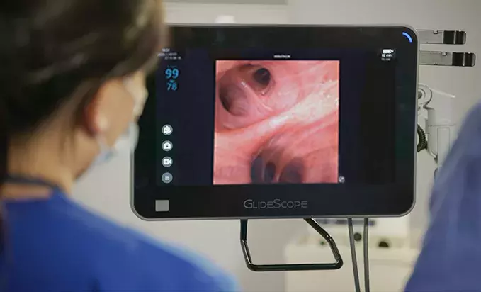 Bronchoscopy Image