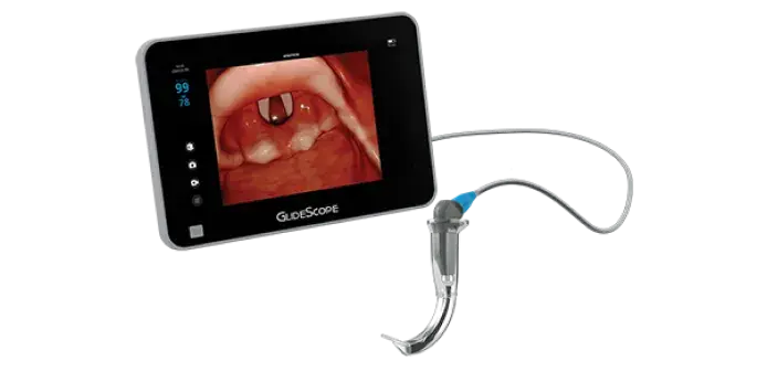 Video baton QC large