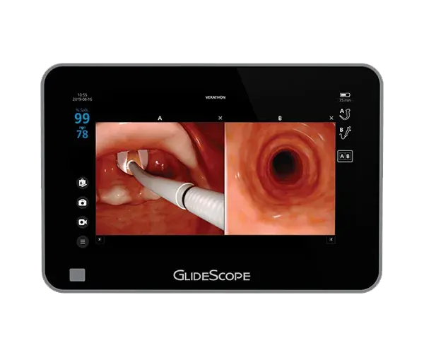 GideScope Core 15