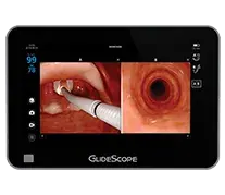 GideScope Core 15