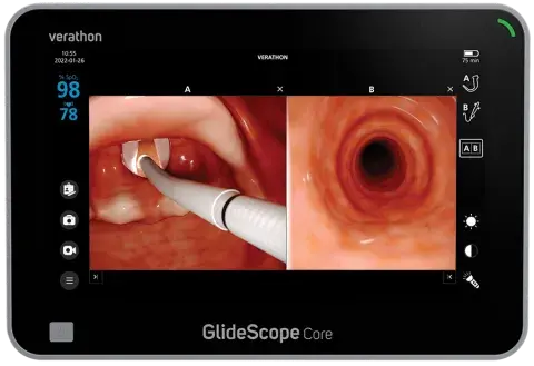 Comparison-Glidescope-core.png